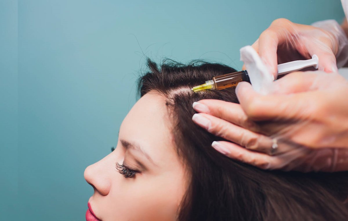 تا چه میزان ریزش مو برای زنان طبیعی است؟