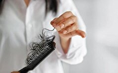 خطر ریزش مو را چگونه با تغذیه کنترل کنیم؟