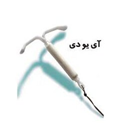 IUD چیست؟ آیا استفاده از آن عوارضی هم دارد؟