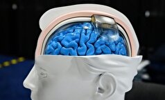 آزمایش ایمپلنت مغزی مبتنی بر گرافن روی انسان!