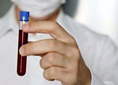 آزمایش معمولی خون سرطان را شناسایی میکند!