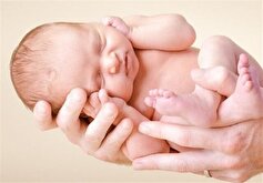 درمان کودکان با ناهنجاری‌های مادرزادی