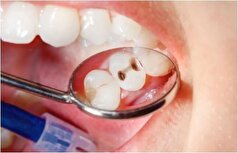 دهان ناسالم و دندان خراب از بیماری کدام عضو بدن خبر می‌دهند؟
