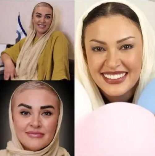 عکس/ تغییر چهره غیرقابل باور زیبا بروفه
