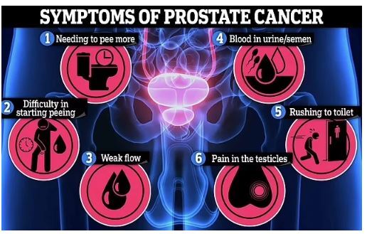 اهمیت داشتن رابطه جنسی منظم در پیشگیری از ابتلا به سرطان پروستات در آقایان