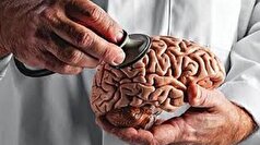 شگفتی‌های مغز انسان ۳۰ برابر بیشتر از ابرکامپیوتر‌های فعلی جهان