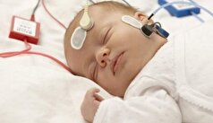 مراجعه به موقع اولین عامل برای درمان کم شنوایی در نوزادان
