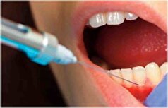 علت بی حس نشدن دندان‌ها بعد از تزریق آمپول بی حسی چیست؟