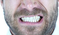 اگر به سلامتی دندان هایتان اهمیت می‌دهید این اشتباهات را هرگز انجام ندهید