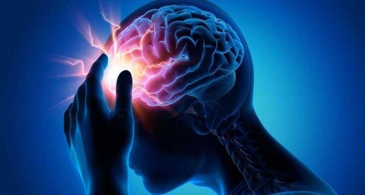 روزانه ۲ نفر در نیشابور دچار سکته مغزی می‌شوند