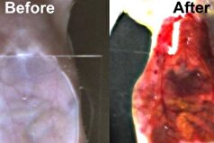 ماده‌ای که پوست را برای پیدا کردن رگ بیماران شفاف و نامرئی میکند!
