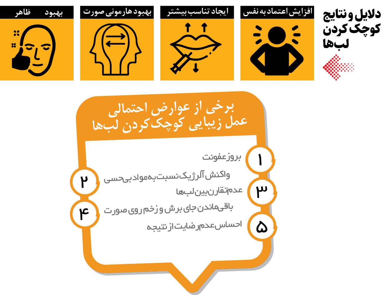 وسوسه جراحی کوچک‌کردن لب‌ها و دهان در خانم‌ها و آقایان!