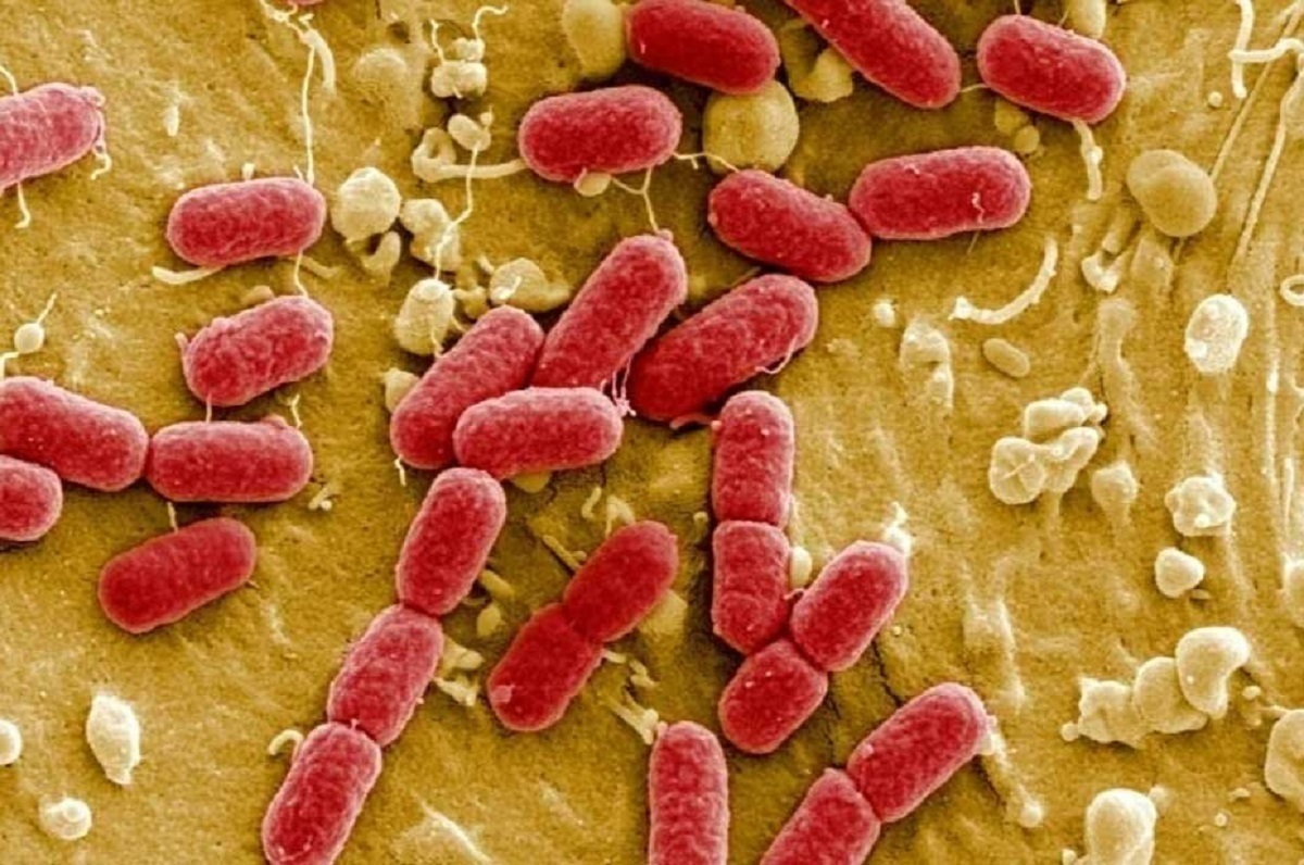 افزایش وحشتناک مرگ‌ومیر ناشی از عفونت MRSA!