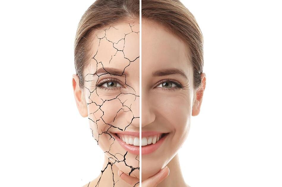 بدون هزینه‌های نجومی یک صورت توپر و بی چین و چروک داشته باشید