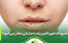 خشکی دهان چرا ایجاد میشود؟