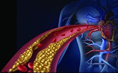 چربی خون زمینه ساز چه بیماری‌هایی می‌شود؟