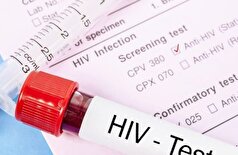 راه‌های انتقال ویروس HIV را بشناسید!