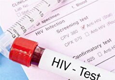 ویروس HIV از چه طریقی منتقل میشود؟