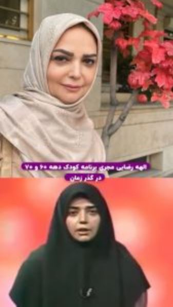 عکس فوق سمی از چهره دهه ۶۰ الهه رضایی /خانم بازیگر شفا پیدا کرد!