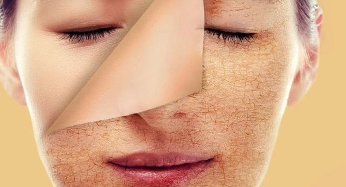 بجای انجام بوتاکس و عمل‌های زیبایی از این خوراکی‌های مفید استفاده کنید