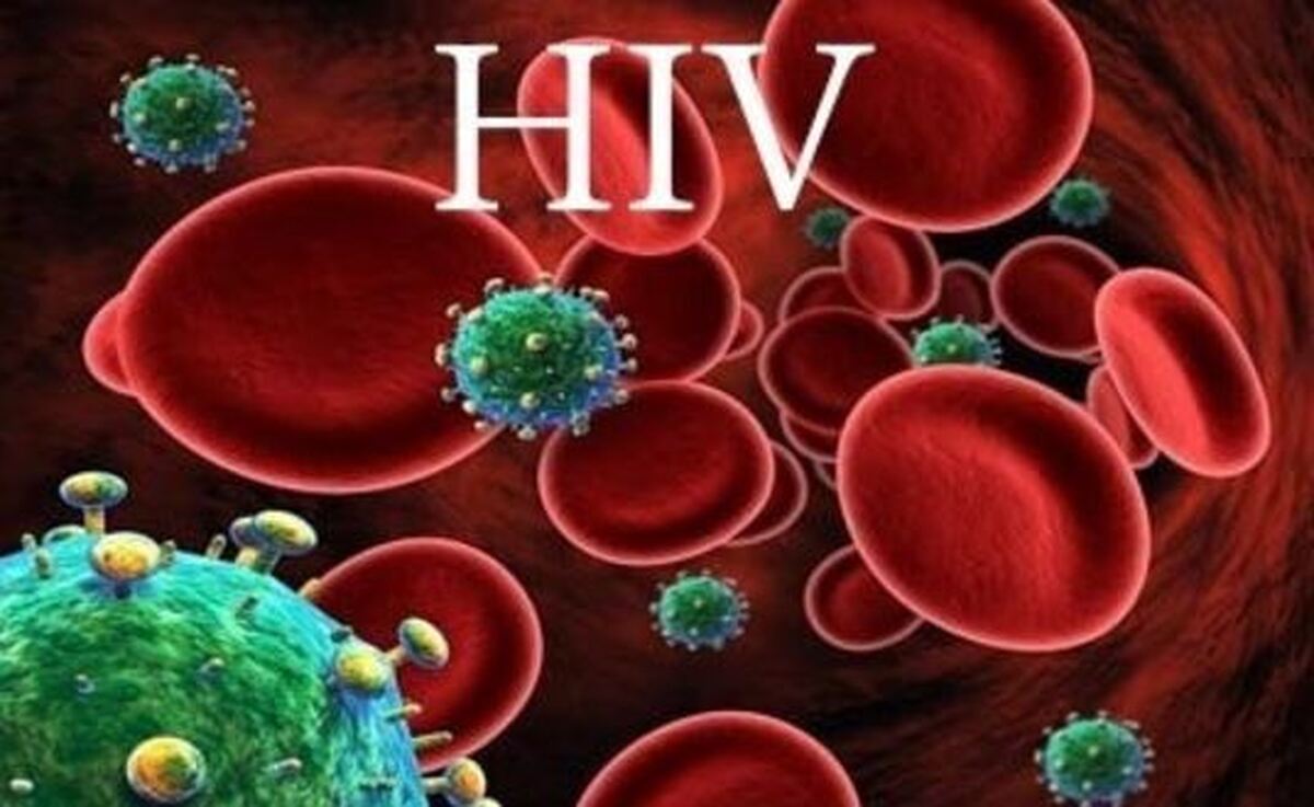 افراد HIV مثبت تا ۱۰ سال هم بدون علامت میتوانند باشند!
