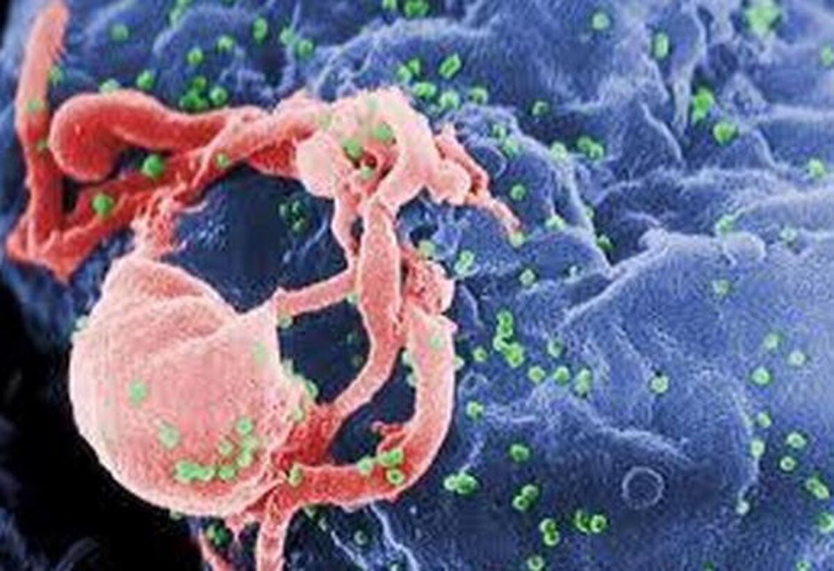 نکات مهم درمورد نحوه انتقال بیماری HIV