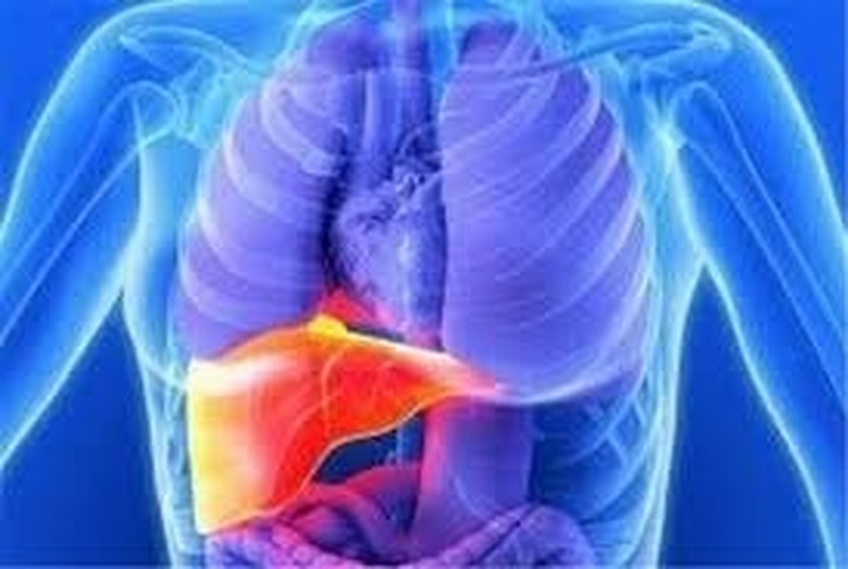 چرا عدم ابتلا به کبد چرب اهمیت دارد؟