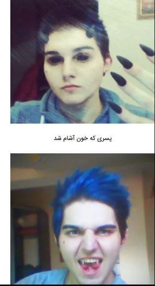 این پسر بدلیل علاقه زیاد به خونآشام‌ها کار دست خودش داد! +عکس