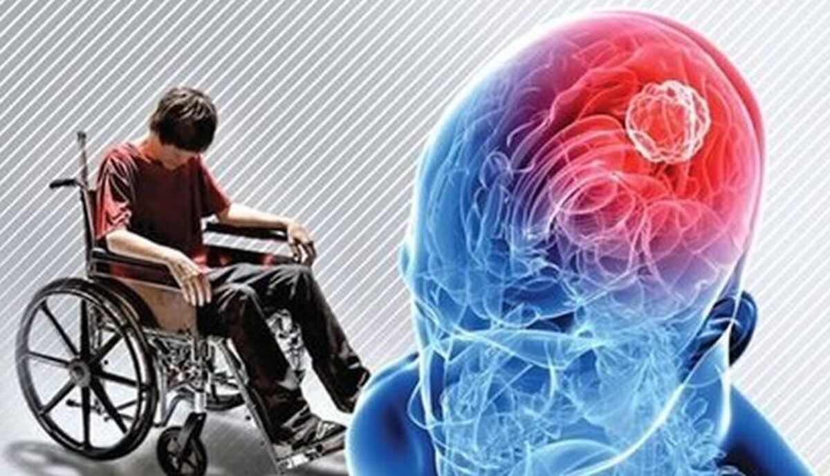 مناسب‌ترین رژیم غذایی برای بیماران مبتلا به «ام‌اس» کدام است؟