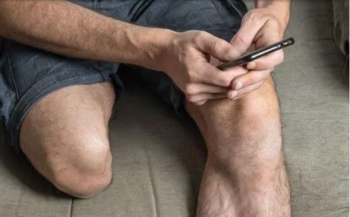 کمک به افراد قطع عضو با کمک این ایمپلنت!