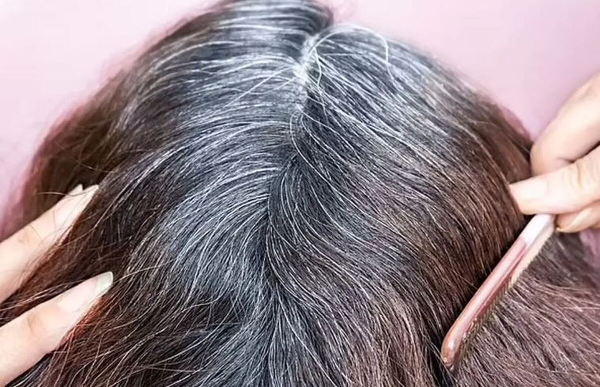 تاثیر مویز در داشتن موهای سالم را جدی بگیرید