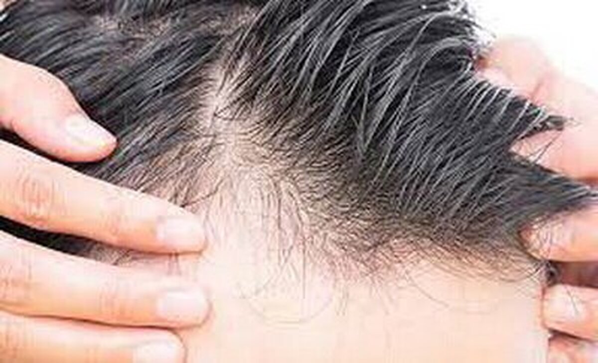 محصولات مرتبط با مراقبت از مویی که غیرمجازند!