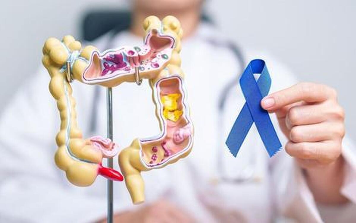 چرا جوانان درگیر بیماری سرطان روده شده‌اند؟