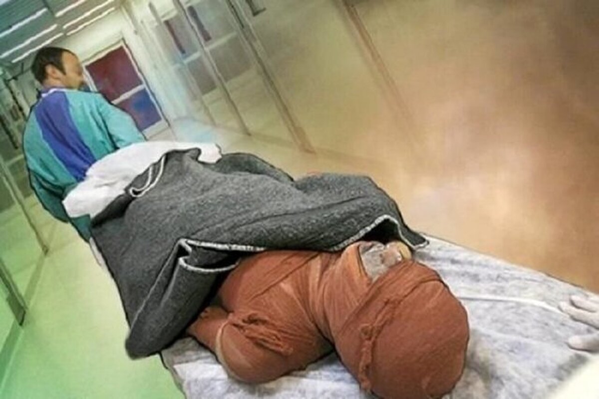 با رعایت چند اصل ساده دچار سوختگی نشوید!