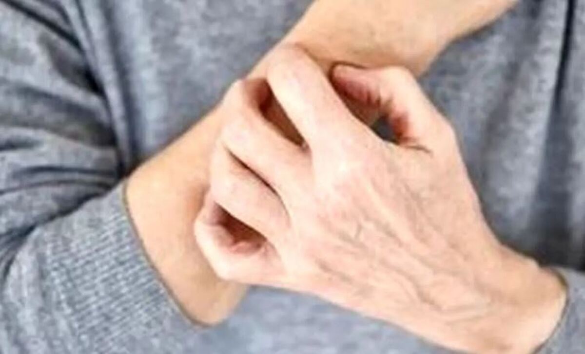 با این نکات از پوستتان در فصول سرما محافظت کنید