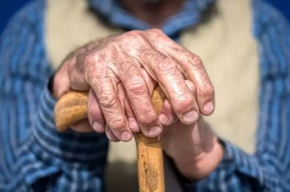 بیماری که باعث پیر شدن یک شبه این زن جوان شد+عکس