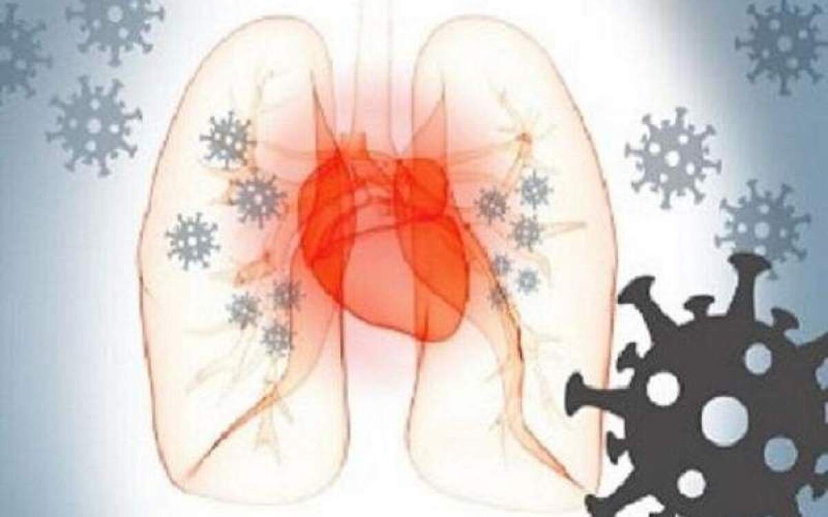 اثرات کرونا بر قلب حتی پس از رفع عفونت هم ادامه دارد؟