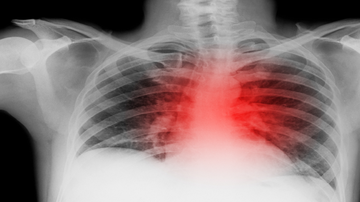 ویتامین مهمی که به تسکین علائم COPD کمک می‌کند