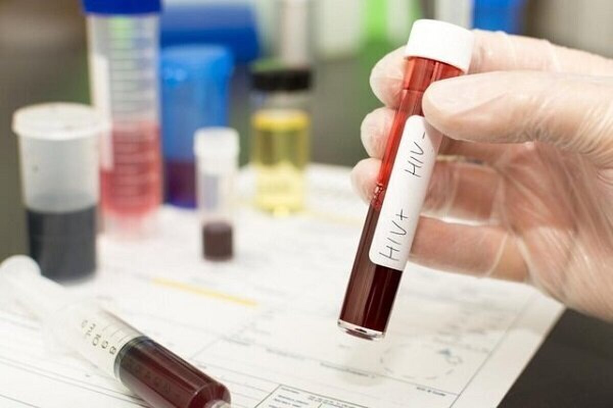 موارد ابتلا به HIV در کشور در حال افزایش!