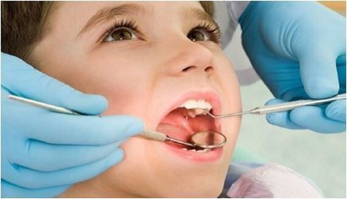 چگونه مانع پوسیدگی دندان شویم؟