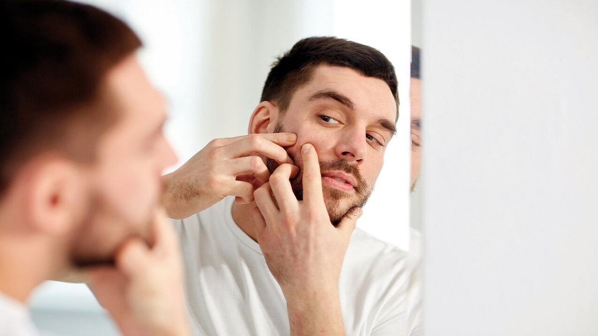 برای مبارزه با آکنه چه باید کرد؟