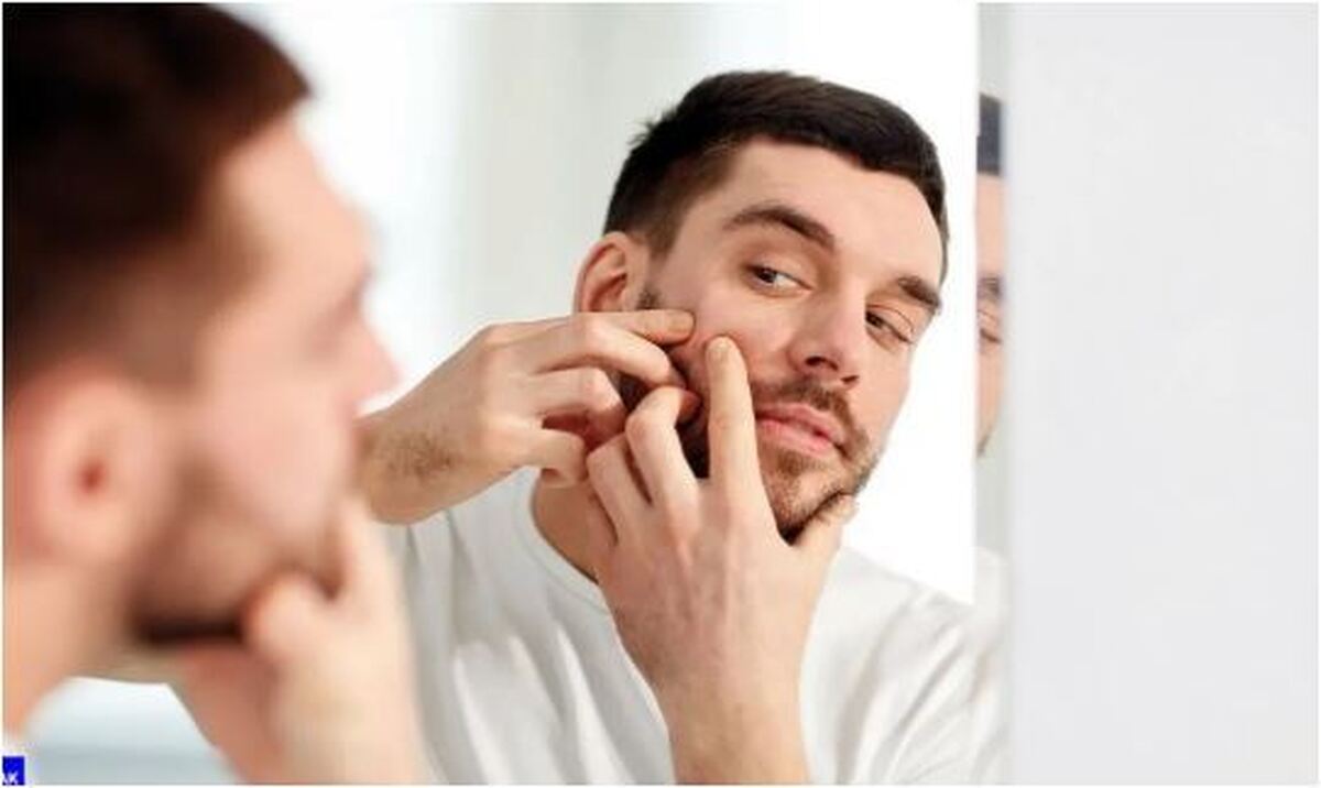 چه کرمی برای مبارزه با آکنه حرف اول را می‌زند؟