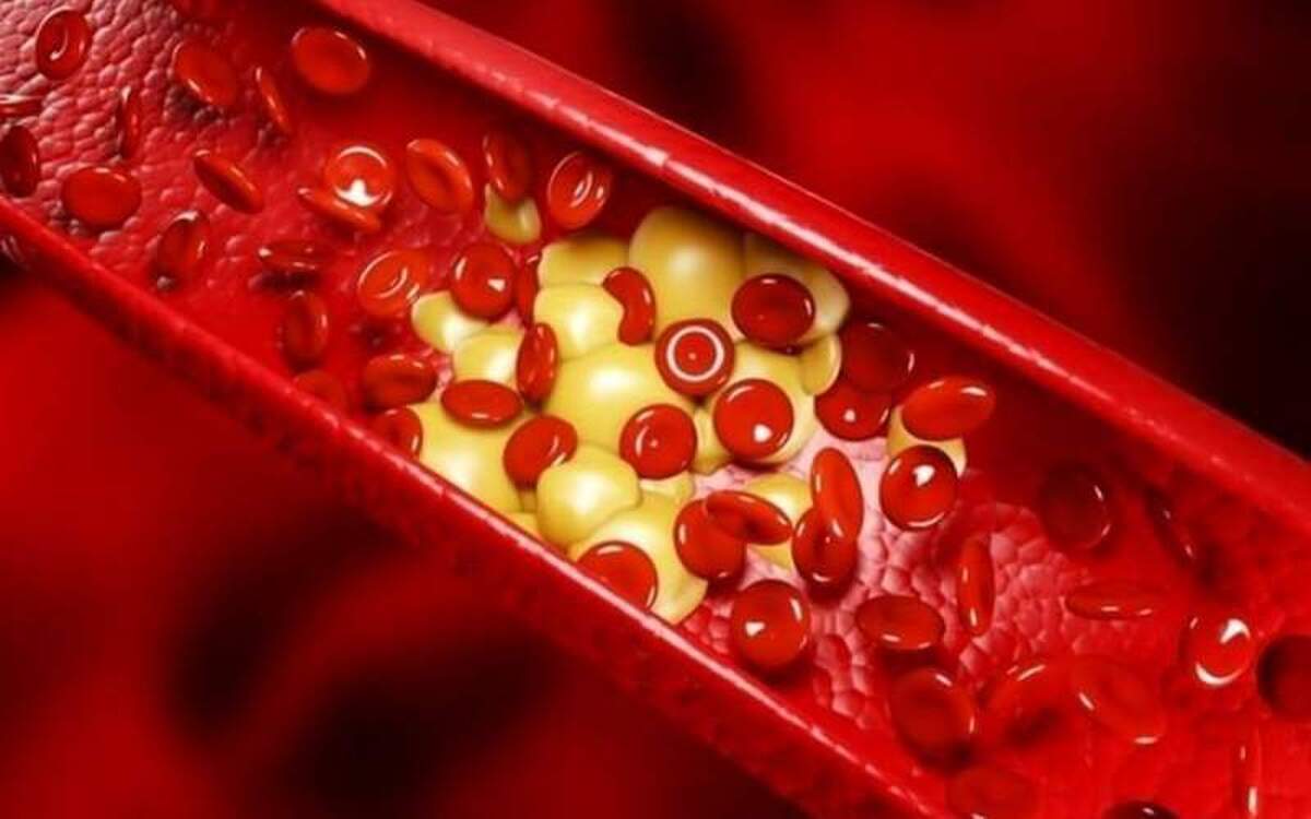 کاهش چربی خون به کمک این مکمل ها!