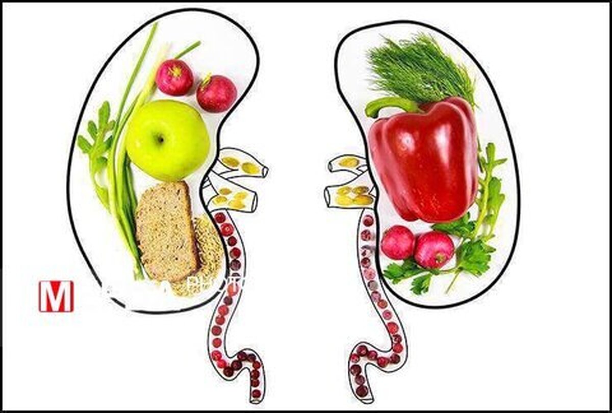 این سبک تغذیه از تشکیل سنگ کلیه و نارسایی کلیوی جلوگیری میکند!