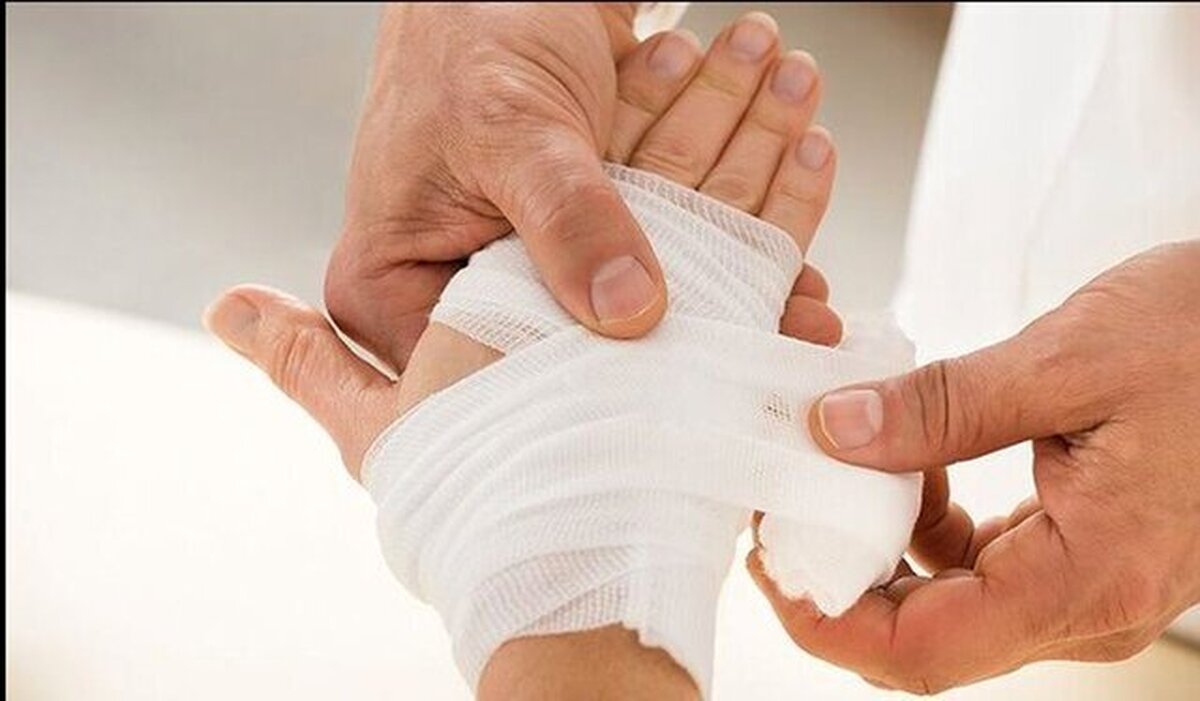 تولید زخم پوش‌های دولایه برای ترمیم زخم‌های مزمن با قدرت کاهش خطر عفونت