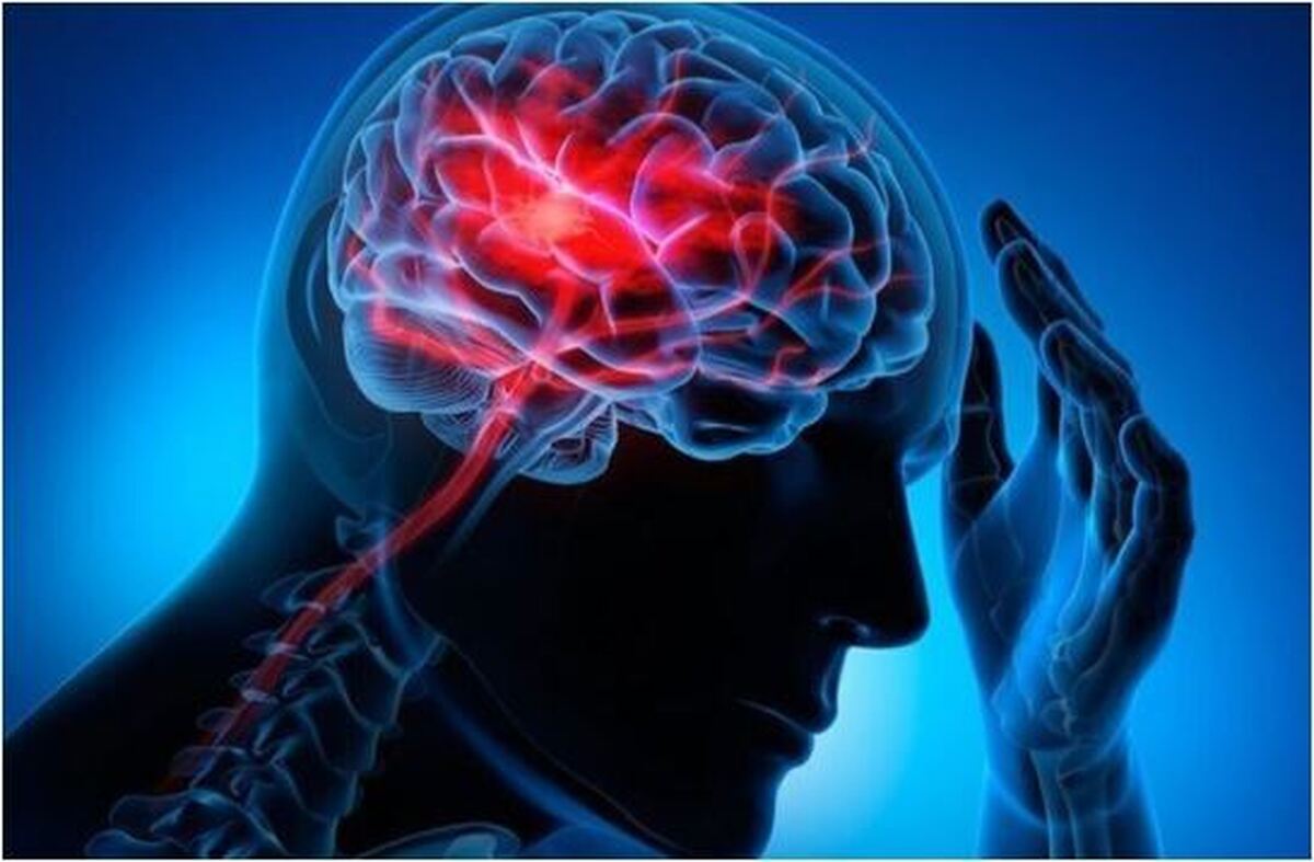دست آورد جدید هوش مصنوعی در تشخیص سکته مغزی در کمتر از پنج دقیقه