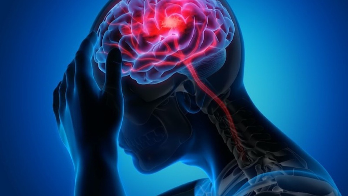نقش فعالیت بدنی و ورزش در کاهش پیشرفت بیماری پارکینسون!
