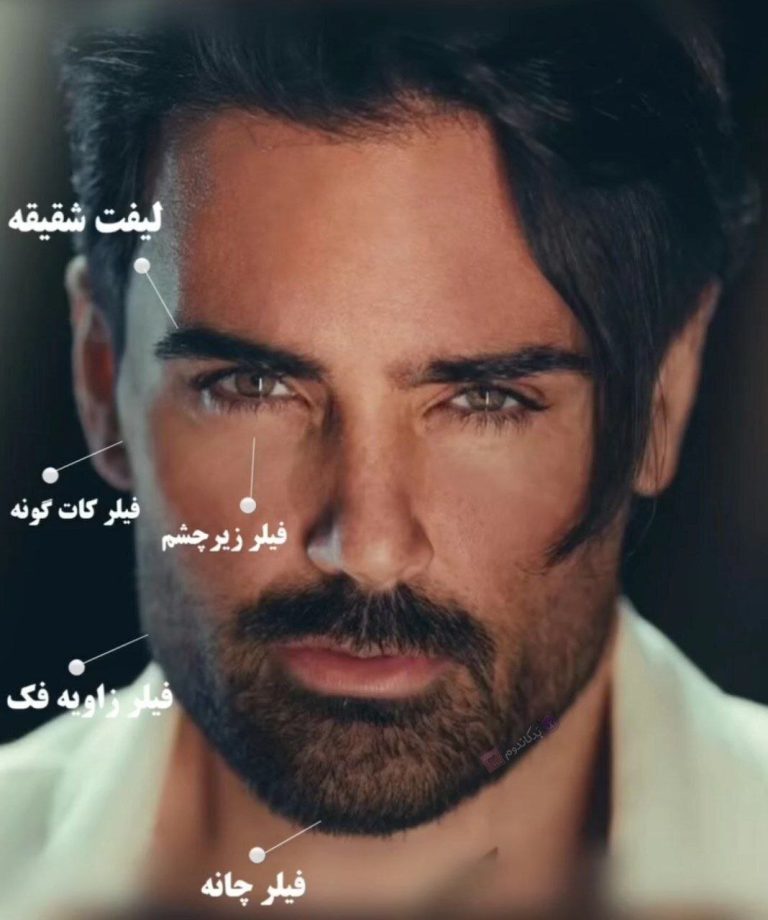 تغییرات سهراب پاکزاد بعد از عمل‌های زیبایی همه را شوکه کرد!