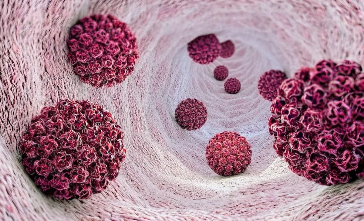 بیماری های قلبی وعروقی در کمین افرادی که به بیماری HPV مبتلا هستند