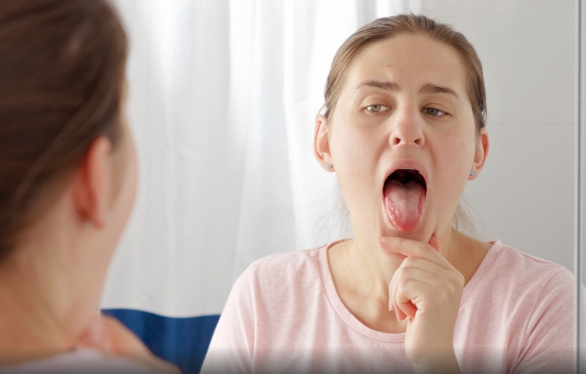 انکولوژیست علائم اصلی سرطان گردن و سر را نام برد
